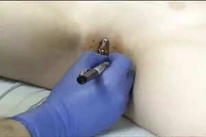 刺穿