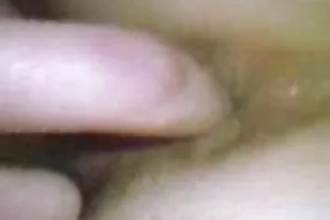 医生凯瑞李得到病人的腿之间的语言和成员