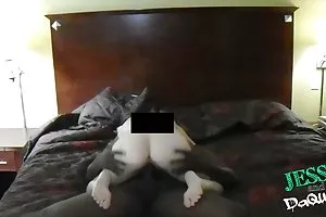黑发会得癌症